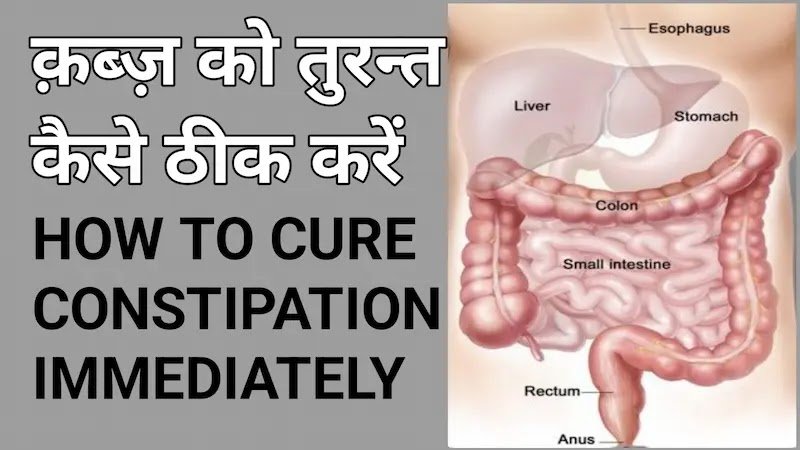 How to cure constipation immediately