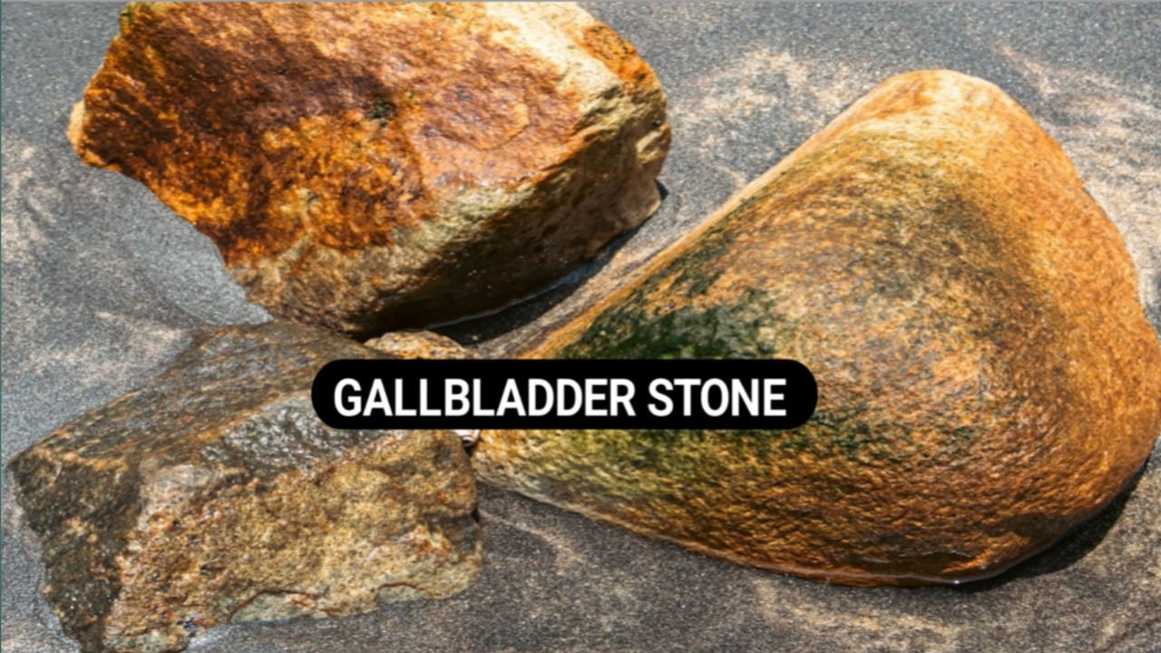 Gallbladder stone treatment in hindi